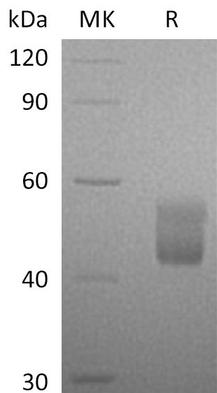 BL-0746NP: Greater than 95% as determined by reducing SDS-PAGE. (QC verified)Recombinant Human CFHR3 Protein (C-6His)