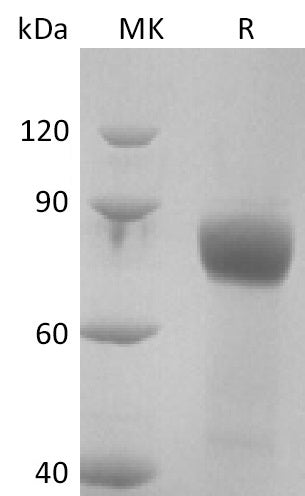 BL-2841NP: Greater than 95% as determined by reducing SDS-PAGE. (QC verified)Recombinant Human IL-18RAcP Protein (C-Fc-6His)
