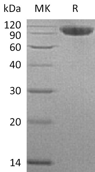 BL-0745NP: Greater than 95% as determined by reducing SDS-PAGE. (QC verified)Recombinant Human CFHR4 Protein (C-6His)