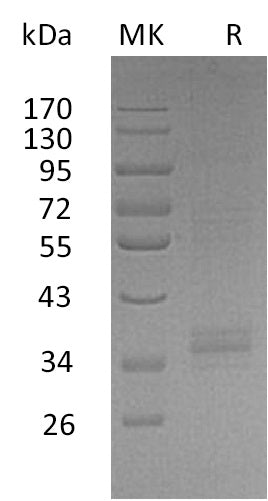 BL-0046NP: Greater than 90% as determined by reducing SDS-PAGE. (QC verified)Recombinant Human TREML2 Protein (C-Fc)
