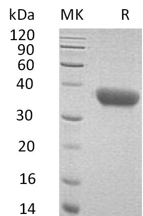 BL-0751NP: Greater than 95% as determined by reducing SDS-PAGE. (QC verified)Recombinant Mouse CXCL16 Protein (C-6His)