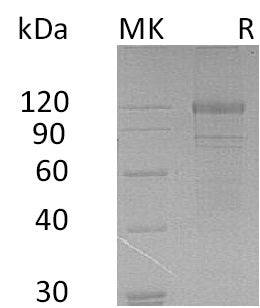 BL-0240NP: Greater than 95% as determined by reducing SDS-PAGE. (QC verified)Recombinant Human FLT3 Protein (C-Fc)