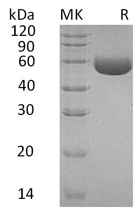 BL-1442NP: Greater than 95% as determined by reducing SDS-PAGE. (QC verified)Recombinant Human CPM Protein (C-6His)