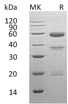 BL-1441NP: Greater than 95% as determined by reducing SDS-PAGE. (QC verified)Recombinant Human CPE Protein (C-6His)