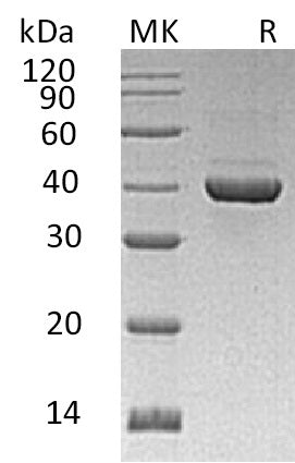 BL-1438NP: Greater than 95% as determined by reducing SDS-PAGE. (QC verified)Recombinant Human ALDOC Protein (C-6His)