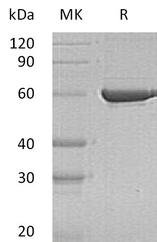 BL-1400NP: Greater than 95% as determined by reducing SDS-PAGE. (QC verified)Recombinant Human PKLR Protein (C-6His)