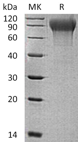 BL-0663NP: Greater than 95% as determined by reducing SDS-PAGE. (QC verified)Recombinant Human MANSC1 Protein (C-6His)