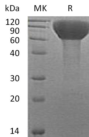 BL-0662NP: Greater than 95% as determined by reducing SDS-PAGE. (QC verified)Recombinant Human FLRT3 Protein (C-6His)