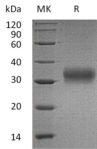 BL-0658NP: Greater than 95% as determined by reducing SDS-PAGE. (QC verified)Recombinant Human AMBP Protein (C-6His)