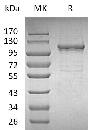 BL-1403NP: Greater than 95% as determined by reducing SDS-PAGE. (QC verified)Recombinant Human IDE Protein (C-6His)