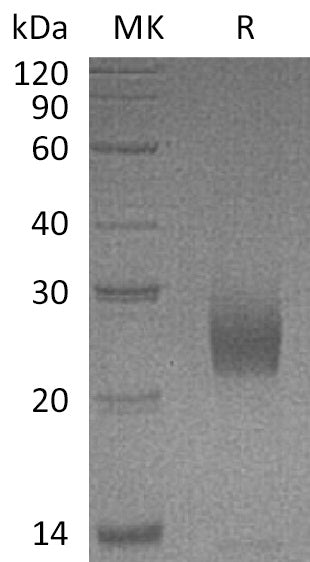 BL-0671NP: Greater than 95% as determined by reducing SDS-PAGE. (QC verified)Recombinant Human UPK2 Protein (C-6His)
