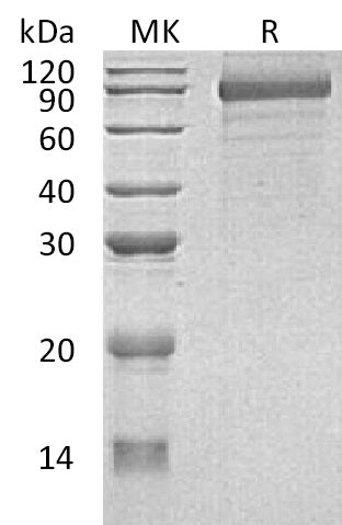 BL-0670NP: Greater than 90% as determined by reducing SDS-PAGE. (QC verified)Recombinant Human CDH8 Protein (C-6His)