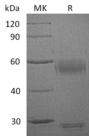 BL-1838NP: Greater than 95% as determined by reducing SDS-PAGE. (QC verified)Recombinant Human MMP-8 Protein (C-10His)
