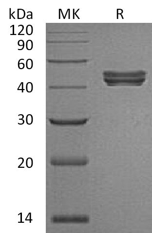 BL-1402NP: Greater than 95% as determined by reducing SDS-PAGE. (QC verified)Recombinant Human Sialidase-1 Protein (C-6His)