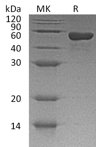 BL-0667NP: Greater than 95% as determined by reducing SDS-PAGE. (QC verified)Recombinant Human sCD4 Protein (C-6His)