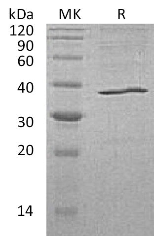 BL-0664NP: Greater than 95% as determined by reducing SDS-PAGE. (QC verified)Recombinant Human AKR1C3 Protein (C-6His)