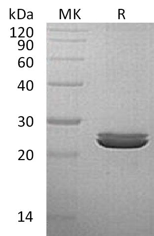 BL-1405NP: Greater than 95% as determined by reducing SDS-PAGE. (QC verified)Recombinant Human LYG2 Protein (C-6His)
