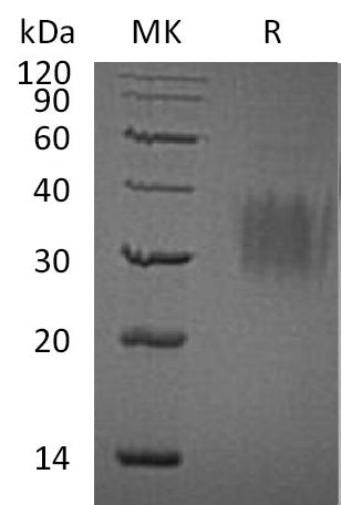BL-1678NP: Greater than 95% as determined by reducing SDS-PAGE. (QC verified)Recombinant Human IL-9 Protein (C-6His)