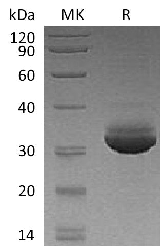 BL-1409NP: Greater than 95% as determined by reducing SDS-PAGE. (QC verified)Recombinant Human CELA3A Protein (C-6His)
