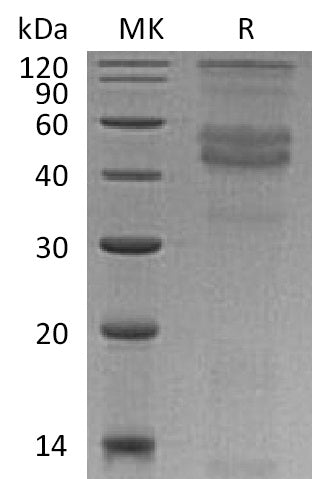 BL-0678NP: Greater than 95% as determined by reducing SDS-PAGE. (QC verified)Recombinant Human DMP-1 Protein (C-6His)