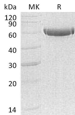 BL-1410NP: Greater than 95% as determined by reducing SDS-PAGE. (QC verified)Recombinant Human CPB2 Protein (C-6His)