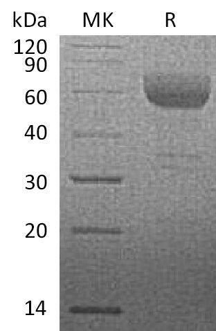 BL-0026NP: Greater than 95% as determined by reducing SDS-PAGE. (QC verified)Recombinant Rhesus Macaque HVEM Protein (C-Fc)