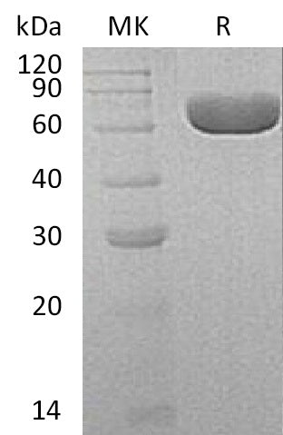 BL-1407NP: Greater than 95% as determined by reducing SDS-PAGE. (QC verified)Recombinant Human SIAE Protein (C-6His)