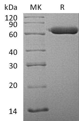 BL-1406NP: Greater than 95% as determined by reducing SDS-PAGE. (QC verified)Recombinant Human SGSH Protein (C-6His)