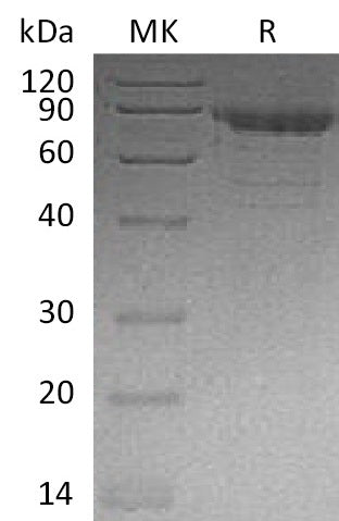 BL-0686NP: Greater than 95% as determined by reducing SDS-PAGE. (QC verified)Recombinant Human CDH11 Protein (C-6His)