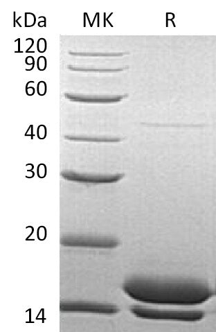 BL-1414NP: Greater than 95% as determined by reducing SDS-PAGE. (QC verified)Recombinant Human Elafin Protein (C-6His)