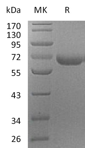 BL-1413NP: Greater than 95% as determined by reducing SDS-PAGE. (QC verified)Recombinant Human PRCP Protein (C-6His)