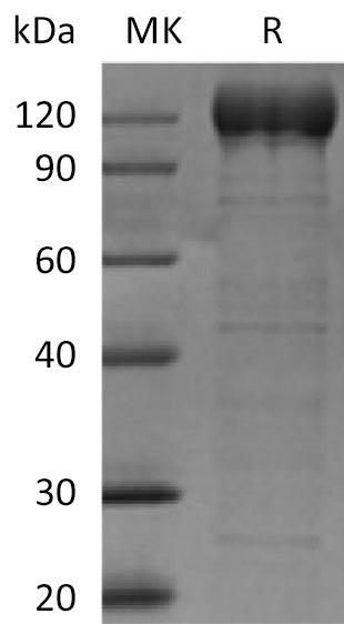 BL-0211NP: Greater than 95% as determined by reducing SDS-PAGE. (QC verified)Recombinant Human AOC3 Protein (C-Fc)