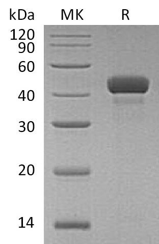 BL-1415NP: Greater than 95% as determined by reducing SDS-PAGE. (QC verified)Recombinant Human RCN3 Protein (C-6His)