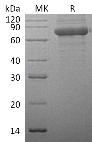BL-1412NP: Greater than 95% as determined by reducing SDS-PAGE. (QC verified)Recombinant Human TPP1 Protein (C-6His)