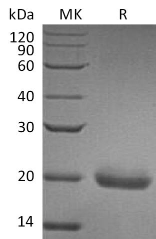BL-0688NP: Greater than 95% as determined by reducing SDS-PAGE. (QC verified)Recombinant Human SECTM1 Protein (C-6His)