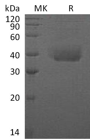BL-0680NP: Greater than 95% as determined by reducing SDS-PAGE. (QC verified)Recombinant Human ANTXR1 Protein (C-6His)