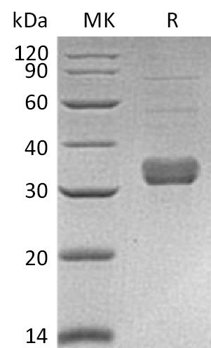 BL-1203NP: Greater than 95% as determined by reducing SDS-PAGE. (QC verified)Recombinant Mouse Collectin-11 Protein (C-6His)