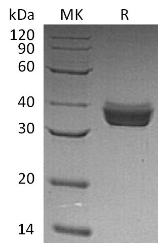 BL-0696NP: Greater than 95% as determined by reducing SDS-PAGE. (QC verified)Recombinant Human ERP27 Protein (C-6His)