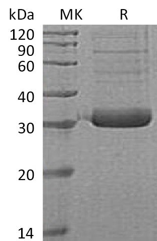 BL-0691NP: Greater than 90% as determined by reducing SDS-PAGE. (QC verified)Recombinant Human Collectin-11 Protein (C-6His)