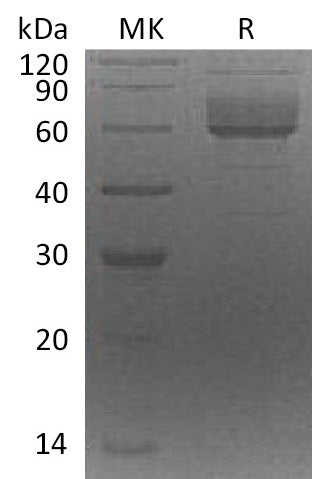 BL-0690NP: Greater than 90% as determined by reducing SDS-PAGE. (QC verified)Recombinant Human CLUL1 Protein (C-6His)