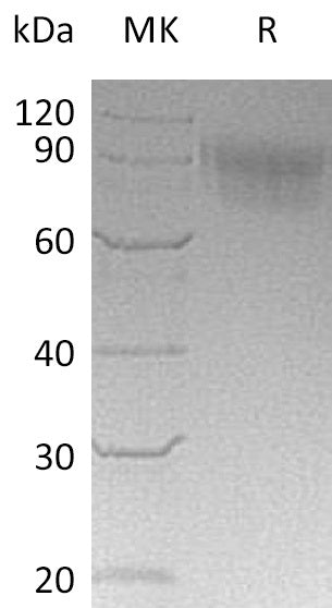 BL-1204NP: Greater than 90% as determined by reducing SDS-PAGE. (QC verified)Recombinant Cynomolgus Siglec-5 Protein (C-6His)