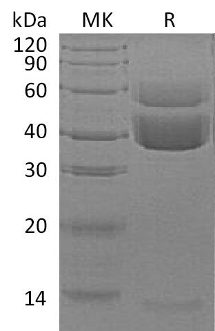 BL-1840NP: Greater than 95% as determined by SEC-HPLC. (Regularly tested)Recombinant Human Latent TGF Beta-1 Protein (N-6His)