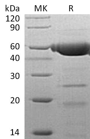 BL-1418NP: Greater than 95% as determined by reducing SDS-PAGE. (QC verified)Recombinant Human PLRP2 Protein (C-6His)