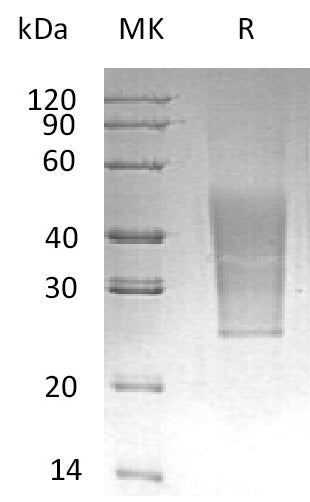 BL-0697NP: Greater than 95% as determined by reducing SDS-PAGE. (QC verified)Recombinant Human CD99L2 Protein (C-6His)