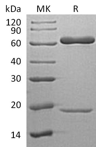 BL-1424NP: Greater than 95% as determined by reducing SDS-PAGE. (QC verified)Recombinant Human PCSK9 Protein (C-6His)