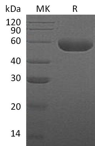 BL-1420NP: Greater than 95% as determined by reducing SDS-PAGE. (QC verified)Recombinant Human HYAL1 Protein (C-6His)