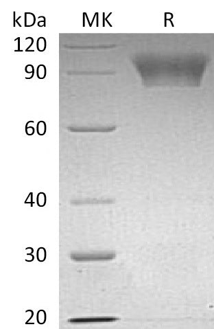 BL-0703NP: Greater than 95% as determined by reducing SDS-PAGE. (QC verified)Recombinant Human NLGN4X Protein (C-6His)