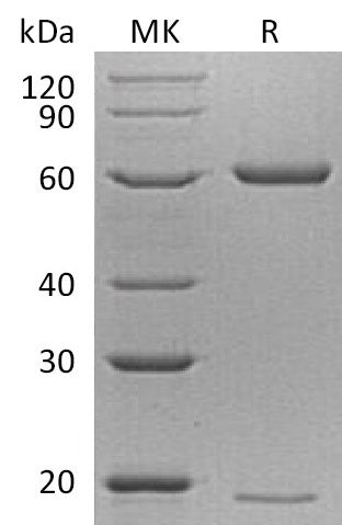 BL-1422NP: Greater than 95% as determined by reducing SDS-PAGE. (QC verified)Recombinant Mouse PCSK9 Protein (C-6His)