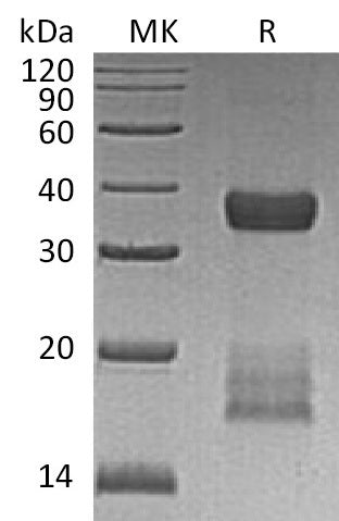 BL-0704NP: Greater than 95% as determined by reducing SDS-PAGE. (QC verified)Recombinant Human CGREF1 Protein (C-6His)