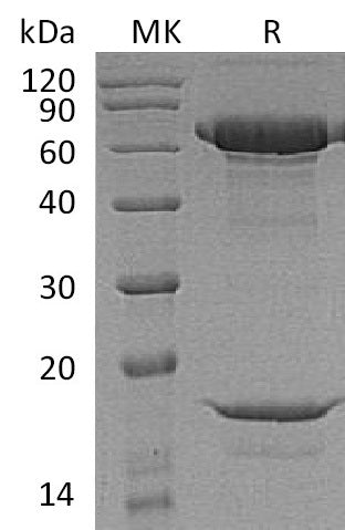 BL-1423NP: Greater than 95% as determined by reducing SDS-PAGE. (QC verified)Recombinant Macaca nemestrina PCSK9 Protein (C-6His)